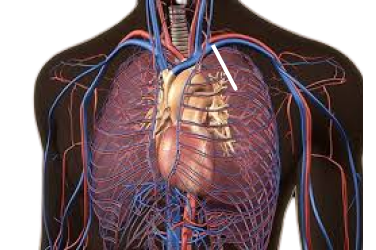 Know About Angiography in Indore